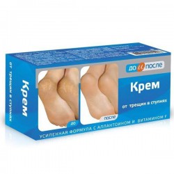 Крем для ног До и после от трещин в ступнях 150 мл